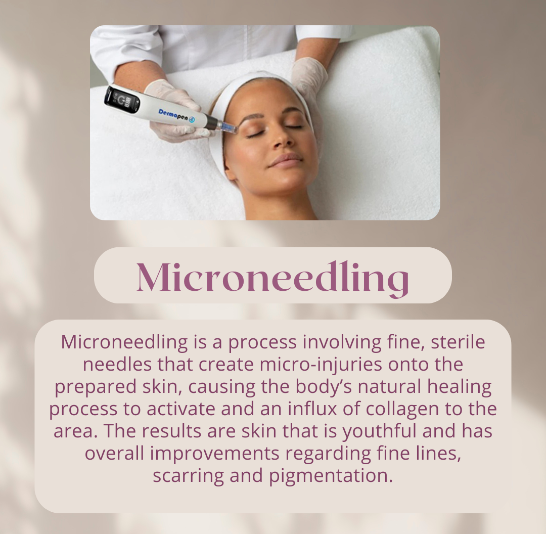 June 2026 special offers
               Microneedling is a process involving fine, sterile needles that create micro-injuries onto the prepared skin,
               causing the body’s natural healing process to activate and an influx of collagen to the area. The results are
               skin that is youthful and has overall improvements regarding fine lines, scarring and pigmentation.