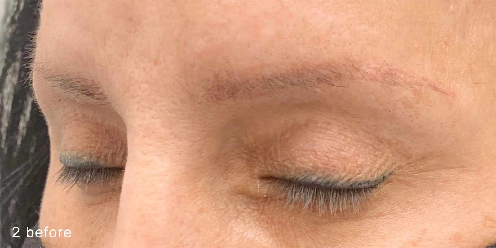 Image of a client's brows prior to nanobrow work.