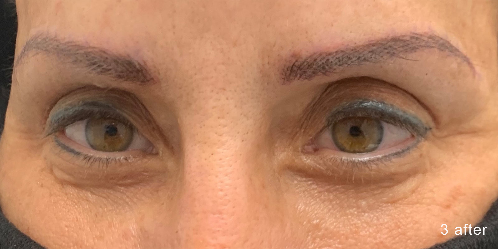 Image of a client's brows after nanobrow work.
