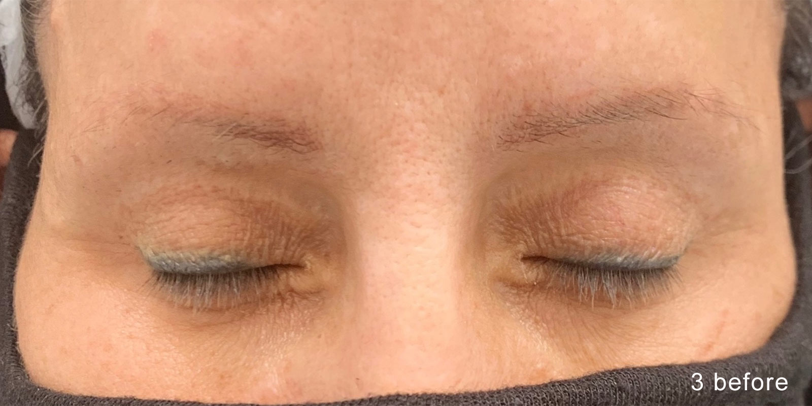 Image of a client's brows prior to nanobrow work.