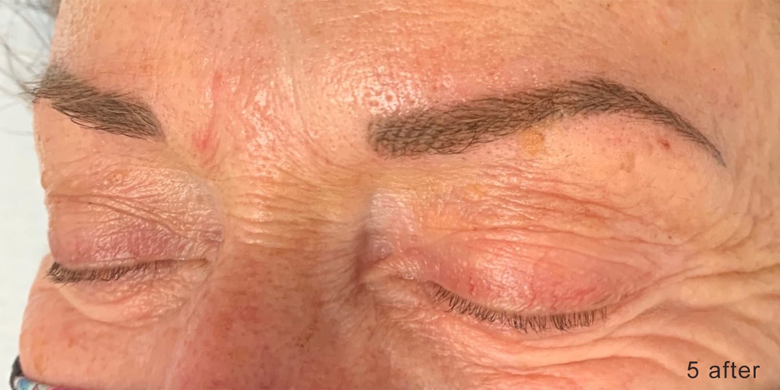 Image of a client's brows after nanobrow work.