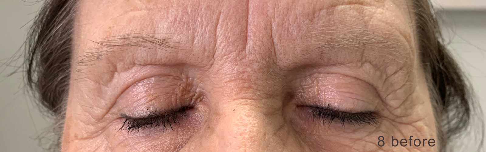 Image of a client's brows prior to nanobrow work.
